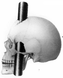 Learn about Dr.  John Martyn Harlow, Phineas Gage's physician after the railroad foreman had a tamping rod rammed through his head. 